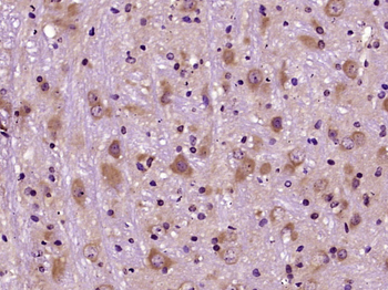 Phospho-Tau (Ser721) Rabbit Polyclonal Antibody