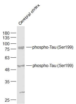 Phospho-Tau (Ser199) Rabbit Polyclonal Antibody