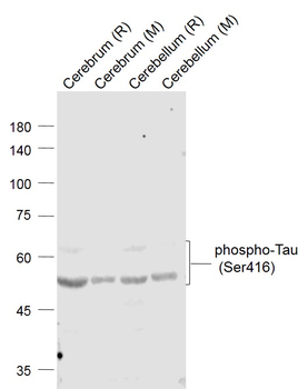 Phospho-Tau (Ser416) Rabbit Polyclonal Antibody