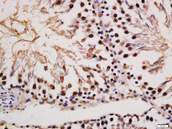 Phospho-MAP2 (Ser136) Rabbit Polyclonal Antibody