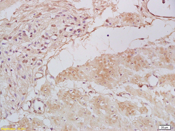 Tbx21 Rabbit Polyclonal Antibody