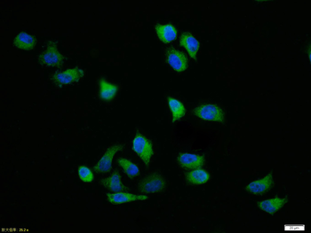 Phospho-TERT (Ser1125) Rabbit Polyclonal Antibody