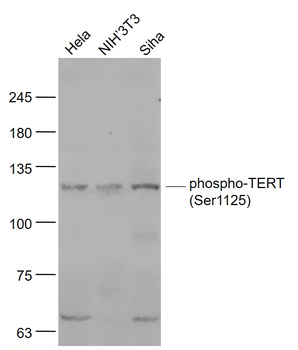 Phospho-TERT (Ser1125) Rabbit Polyclonal Antibody