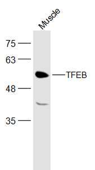 TFEB Rabbit Polyclonal Antibody