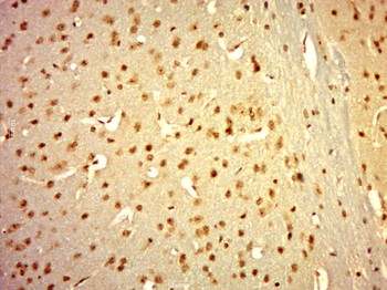 TIF1 gamma Rabbit Polyclonal Antibody