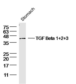 TGF Beta 1+2+3 Rabbit Polyclonal Antibody