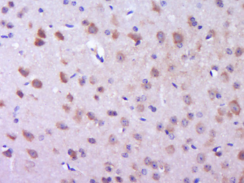 Phospho-P38 MAPK (Thr180) Rabbit Polyclonal Antibody