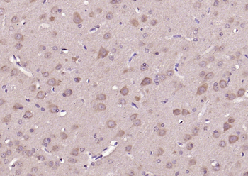 Phospho-P38 MAPK (Thr180) Rabbit Polyclonal Antibody