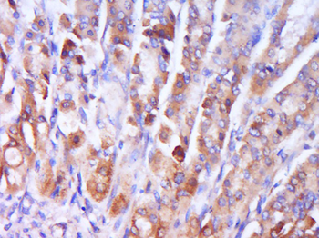 Phospho-P38 MAPK (Thr180) Rabbit Polyclonal Antibody