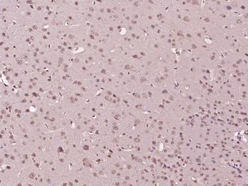 Phospho-p38 MAPK (Tyr323) Rabbit Polyclonal Antibody