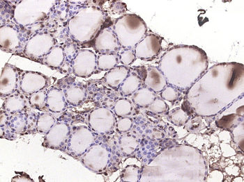 Phospho-p38 MAPK (Tyr323) Rabbit Polyclonal Antibody