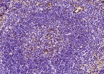 PRAK Rabbit Polyclonal Antibody