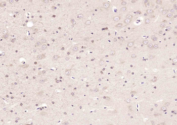 PRAK Rabbit Polyclonal Antibody