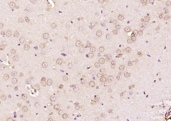 Phospho-MAPKAPK5 (Thr182) Rabbit Polyclonal Antibody