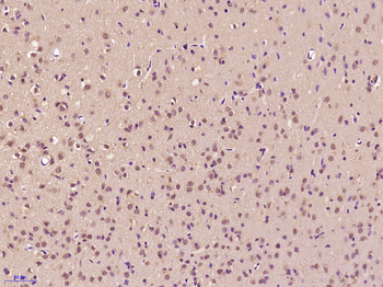 Phospho-MAPKAPK5 (Thr182) Rabbit Polyclonal Antibody