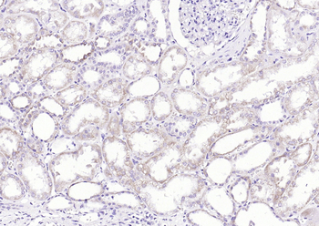 Phospho-Tie2 (Ser1119) Rabbit Polyclonal Antibody