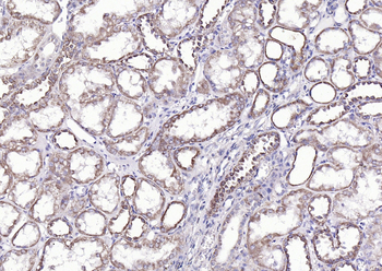 Phospho-Tie2 (Tyr992) Rabbit Polyclonal Antibody