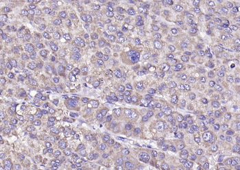Phospho-Tie2 (Tyr992) Rabbit Polyclonal Antibody