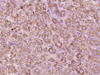 Phospho-Tie2 (Tyr992) Rabbit Polyclonal Antibody