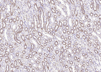 Phospho-Tie2 (Tyr992) Rabbit Polyclonal Antibody