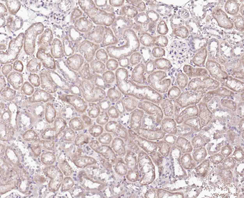 TMEFF2 Rabbit Polyclonal Antibody