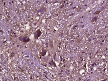 TMEFF2 Rabbit Polyclonal Antibody