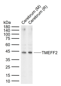 TMEFF2 Rabbit Polyclonal Antibody