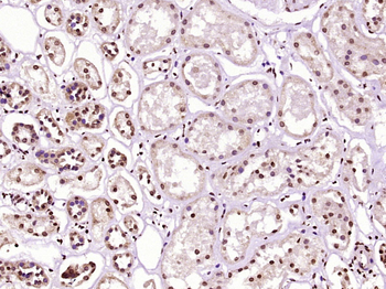 TNFAIP3 Rabbit Polyclonal Antibody