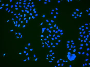 Phospho-TOP2A (Ser1106) Rabbit Polyclonal Antibody