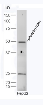 Phospho-TPH (Ser260) Rabbit Polyclonal Antibody