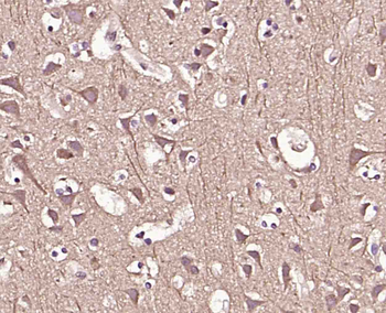 Phospho-p23 (Ser113) Rabbit Polyclonal Antibody