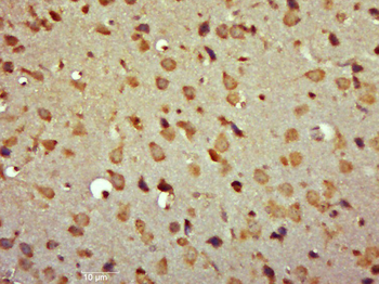 Phospho-TrkA (Tyr496) +TrkB (Tyr516) Rabbit Polyclonal Antibody
