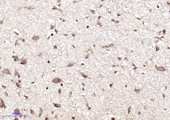 Phospho-TrkB (Tyr515) Rabbit Polyclonal Antibody