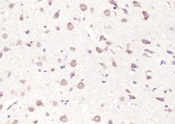 Phospho-TrkB (Tyr515) Rabbit Polyclonal Antibody