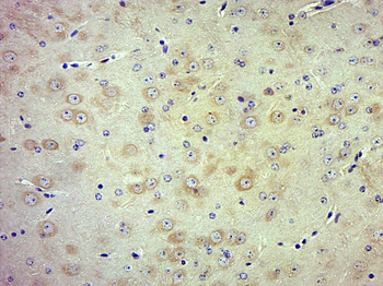 Phospho-TrkB (Tyr705) Rabbit Polyclonal Antibody