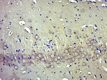 Phospho-TrkB (Tyr705) Rabbit Polyclonal Antibody