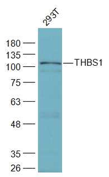 THBS1 Rabbit Polyclonal Antibody