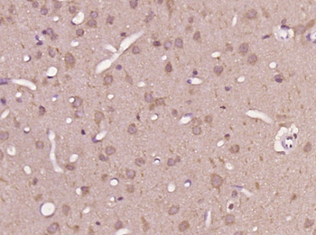 TUBA1C Rabbit Polyclonal Antibody