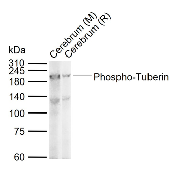 Phospho-Tuberin (Ser939) Rabbit Polyclonal Antibody