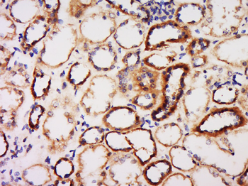 Phospho-Tuberin (Ser664) Rabbit Polyclonal Antibody