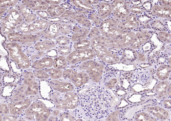 Phospho-Tyk2 (Tyr1054 + Tyr1055) Rabbit Polyclonal Antibody