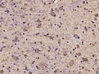 Phospho-Tyk2 (Tyr1054 + Tyr1055) Rabbit Polyclonal Antibody