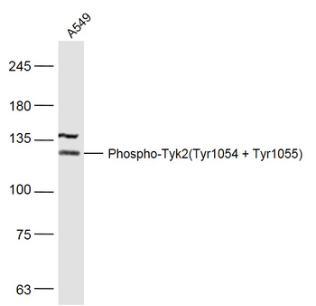 Phospho-Tyk2 (Tyr1054 + Tyr1055) Rabbit Polyclonal Antibody