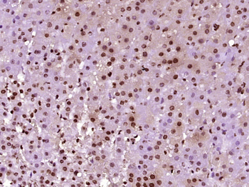 Phospho-TH (Ser31) Rabbit Polyclonal Antibody