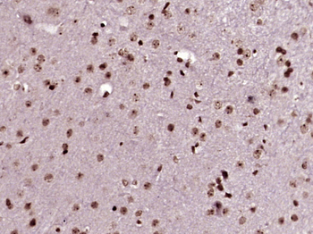 Phospho-TH (Ser31) Rabbit Polyclonal Antibody