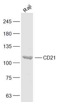 CR2 Rabbit Polyclonal Antibody