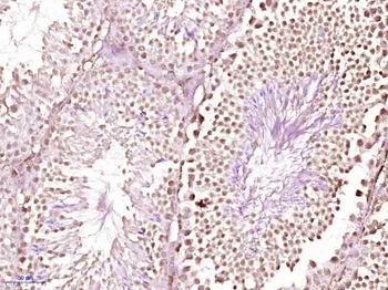 HDAC1 Rabbit Polyclonal Antibody