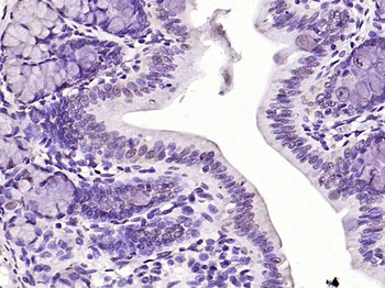 HDAC1 Rabbit Polyclonal Antibody