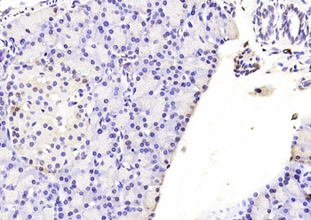 CEBP Beta Rabbit Polyclonal Antibody