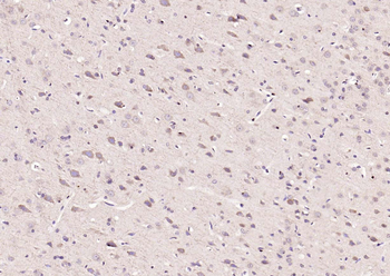 APG4B (Acetyl K39) Rabbit Polyclonal Antibody